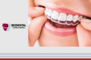 Ortodoncia Invisible con Invisalign