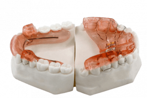 ortodoncia interceptiva en sevilla