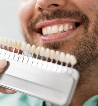 blanqueamiento dental