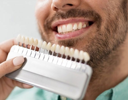 blanqueamiento dental