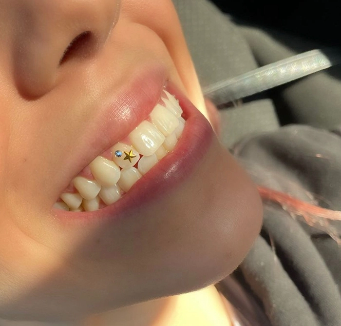 dientes joyas sevilla
